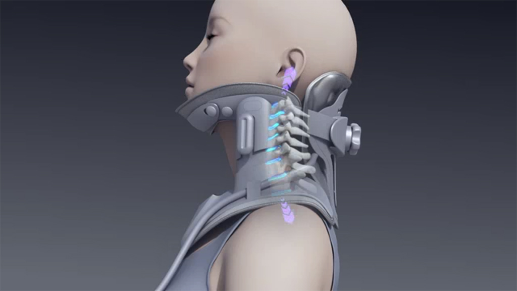Neck Traction Device 1